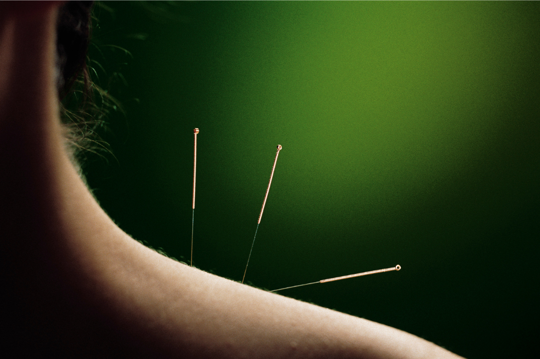 acupuncture shoulder dark elegant pic