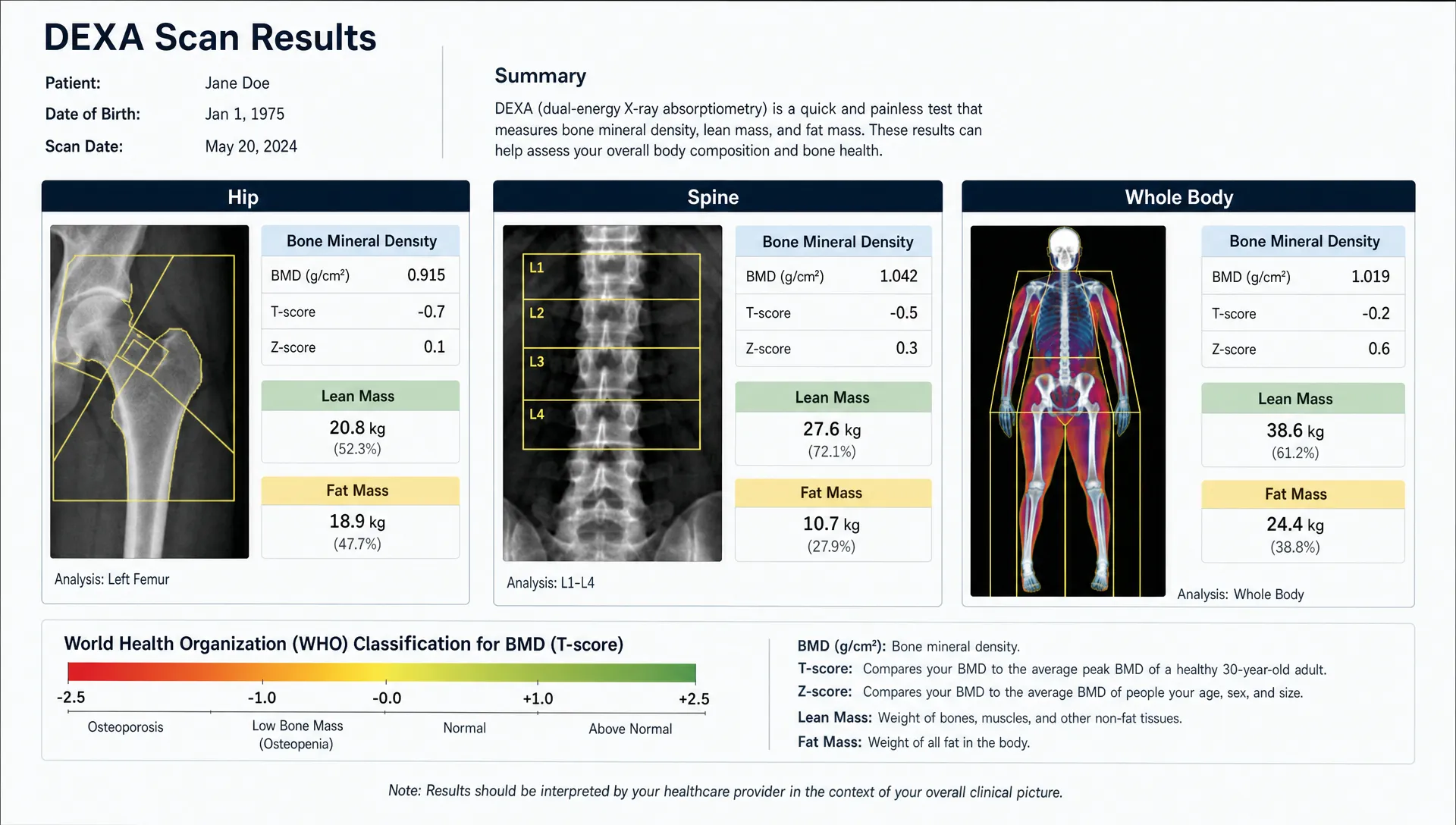 A clean comparison graphic of DEXA results for the hip, spine, and full body, with labeled sections for bone mineral density, lean mass, and fat mass on a neutral background.