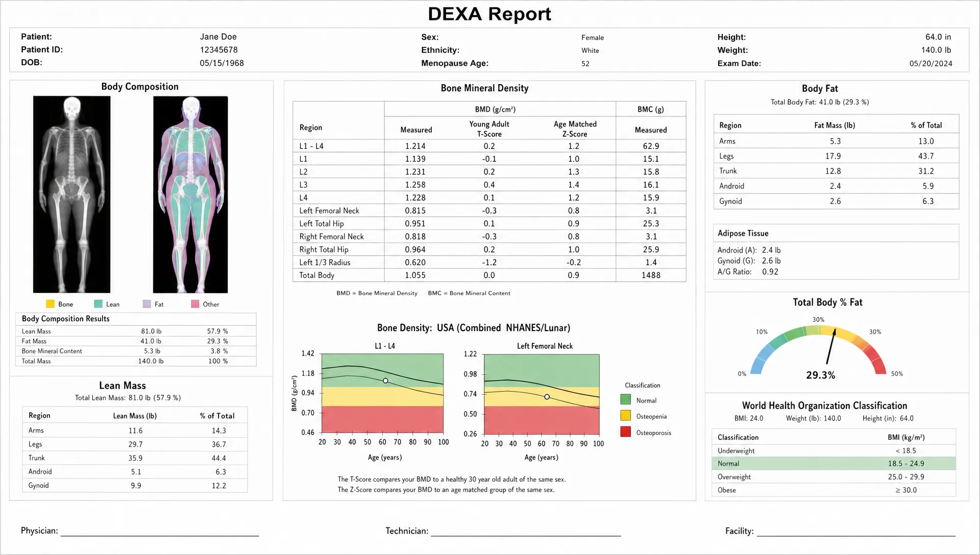 A DEXA report shows bone mineral density, bone mineral content, lean mass, and body fat sections with the bone results centered on the page.