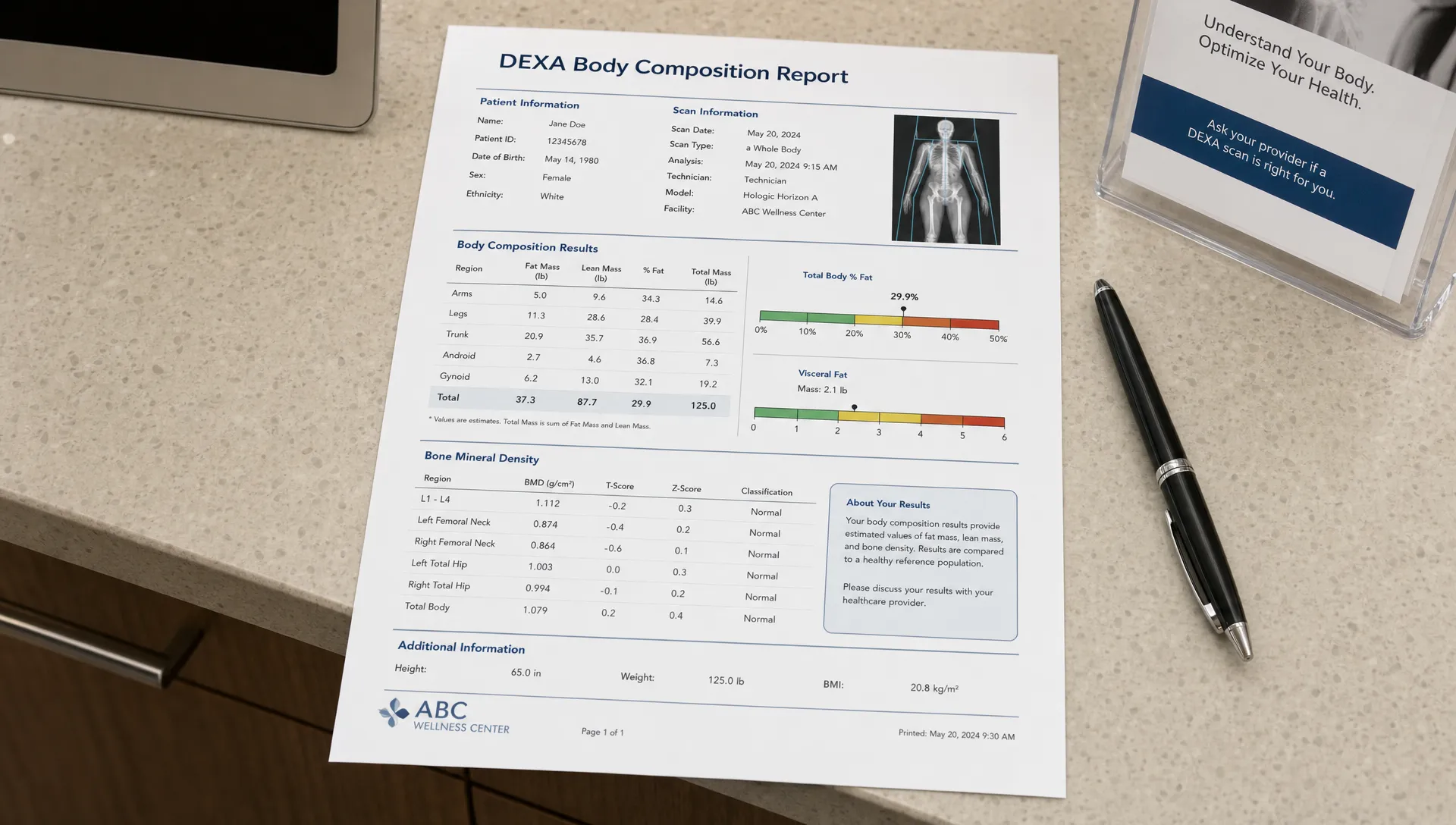 A printed DEXA body composition report on a clinic counter shows fat mass, lean mass, visceral fat, and bone density beside a pen.