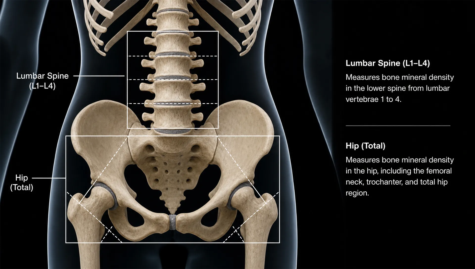 An anatomical view of the pelvis and lower spine highlights the hip and lumbar spine areas measured in a DEXA scan.