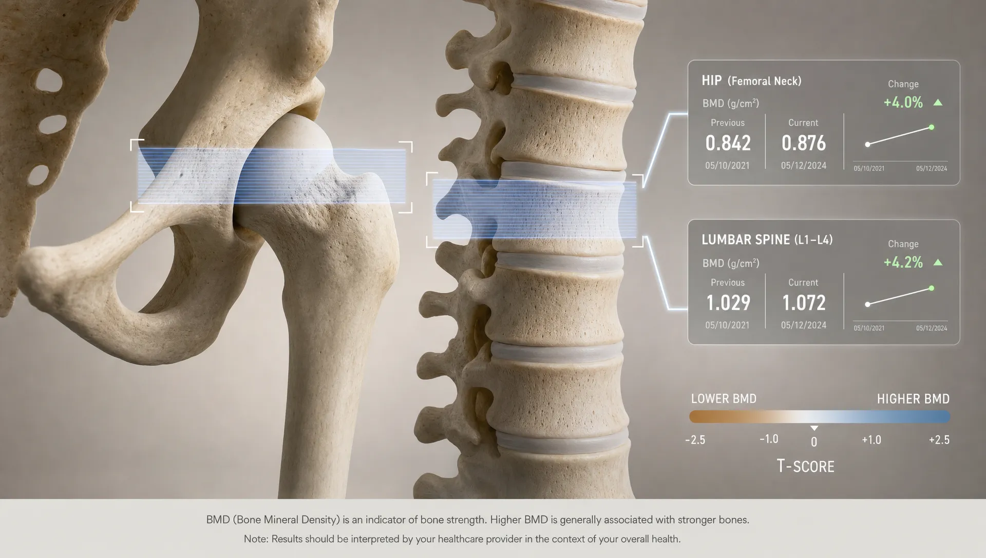 Wide conceptual scene in a neutral space where two measured regions, a hip joint and a lumbar spine segment, are highlighted by subtle scanning bands and calibration marks, then linked to small numeric readouts that suggest comparison over time. No people in frame. The frame should feel like a visual explanation of site-specific bone mineral density rather than a clinic room or document layout, with the hip and spine as the clear focal elements.