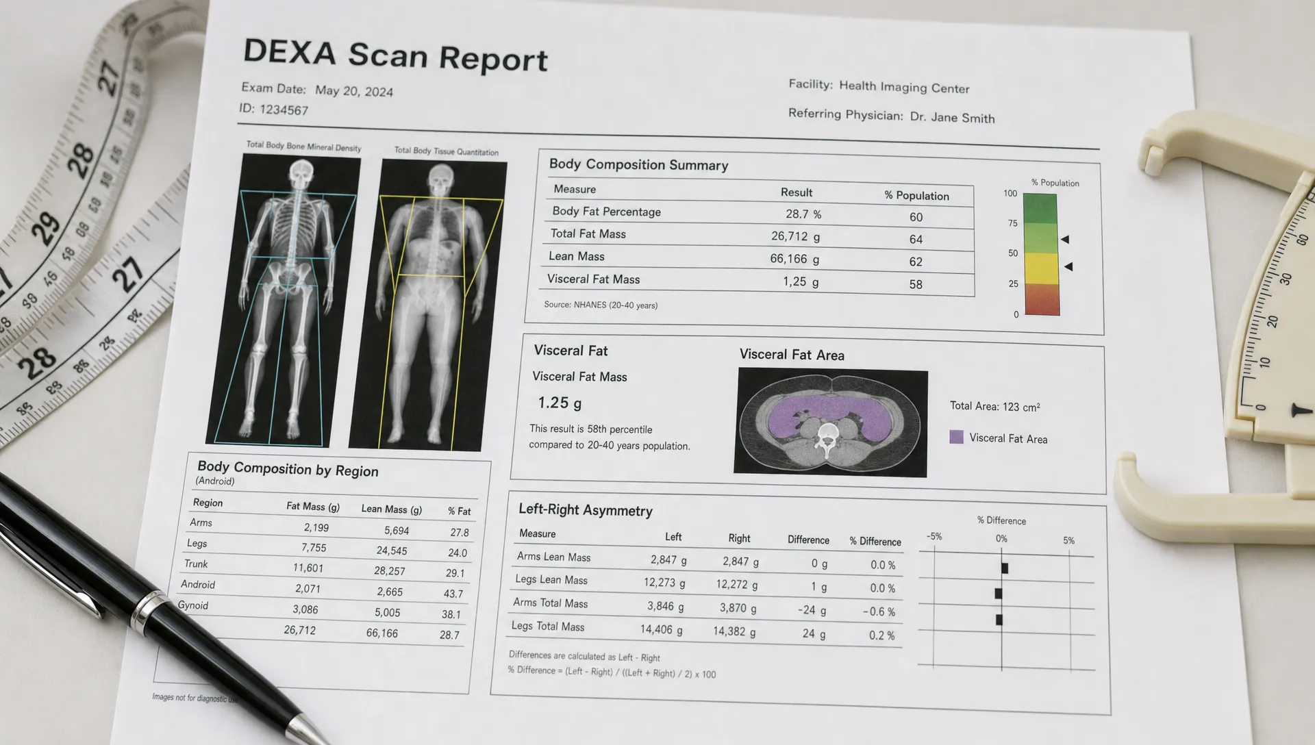 A tight close-up of a DEXA scan printout laid on a clean surface, with a measuring tape, a pen, and a small caliper nearby, and the report sections emphasizing body fat percentage, total fat mass, lean mass, visceral fat, and left-right asymmetry. The paper fills most of the frame, with only a soft neutral background behind it.
