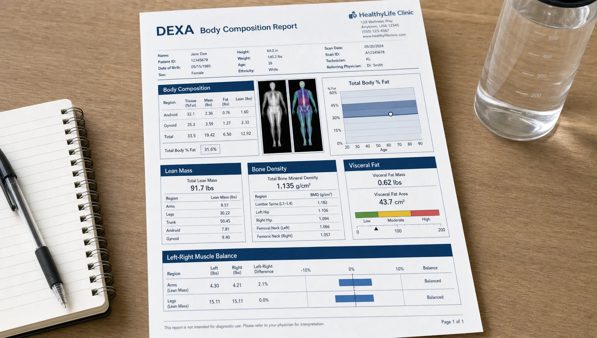A printed DEXA body composition report on a desk showing sections for body fat, lean mass, bone density, visceral fat, and left-right muscle balance, with a notebook and water bottle nearby.
